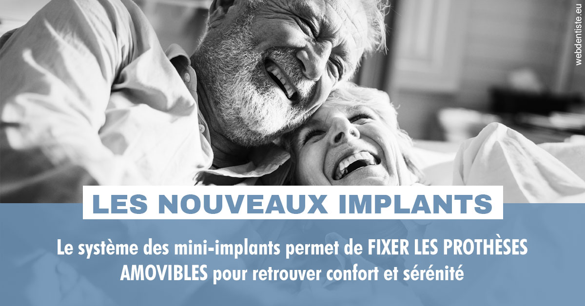 https://dr-teysseire-olivier.chirurgiens-dentistes.fr/Les nouveaux implants 2