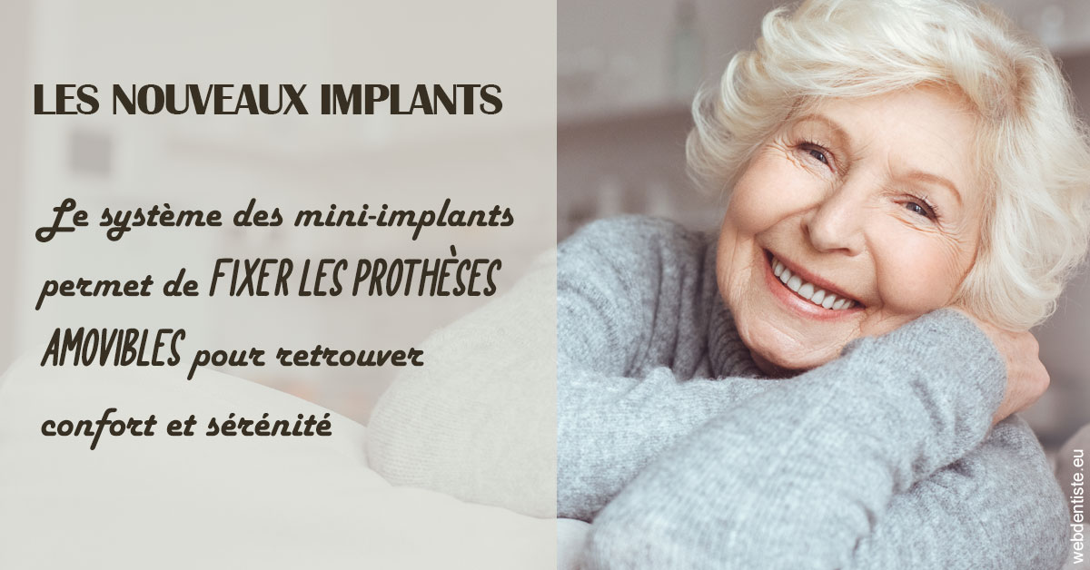 https://dr-teysseire-olivier.chirurgiens-dentistes.fr/Les nouveaux implants 1
