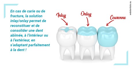 https://dr-teysseire-olivier.chirurgiens-dentistes.fr/L'INLAY ou l'ONLAY