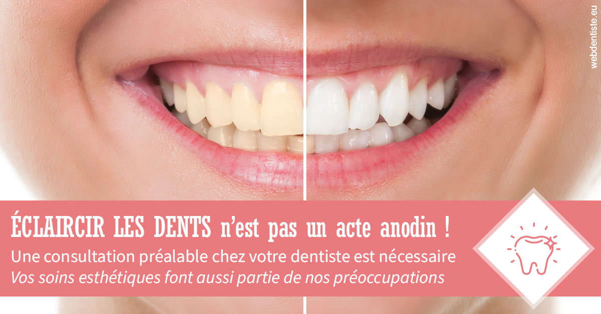 https://dr-teysseire-olivier.chirurgiens-dentistes.fr/Eclaircir les dents 1