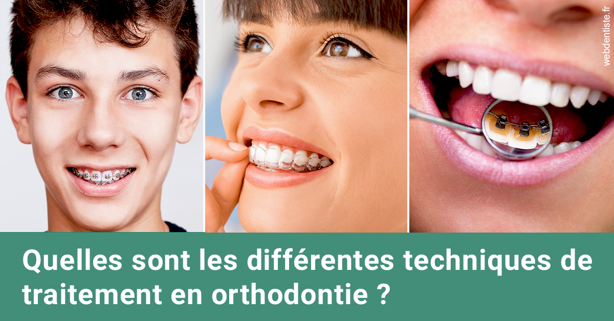 https://dr-teysseire-olivier.chirurgiens-dentistes.fr/Les différentes techniques de traitement 2