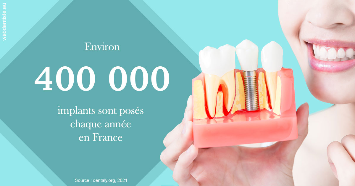 https://dr-teysseire-olivier.chirurgiens-dentistes.fr/Pose d'implants en France 2